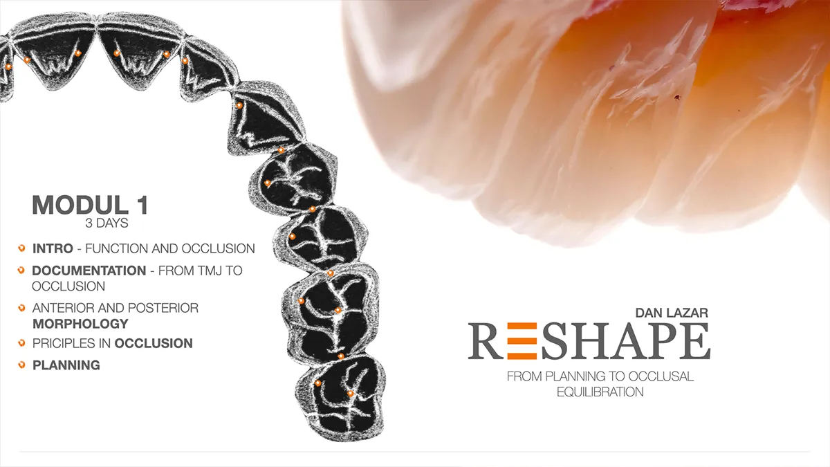 RESHAPE - From Planning to Occlusal Equilibration lazar learning dan lazar oradea (2)